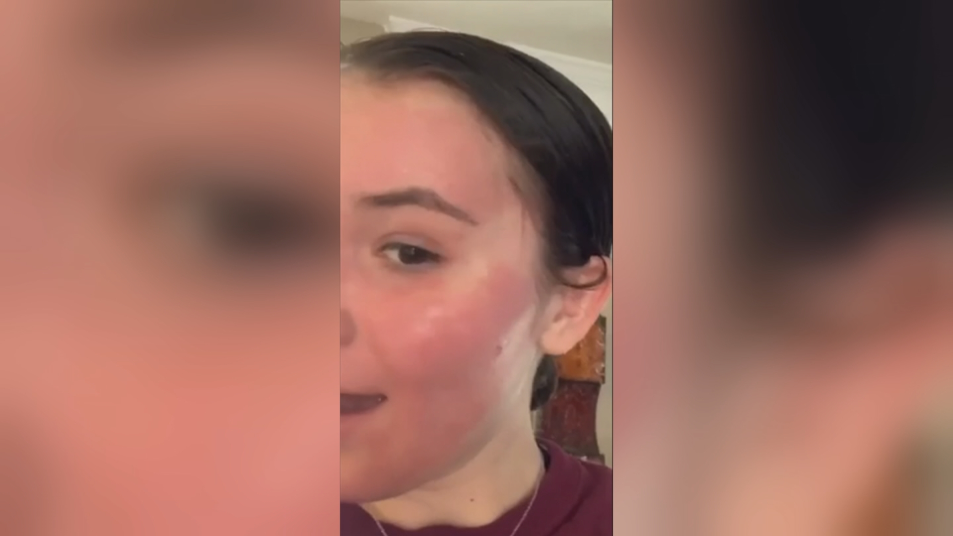 Local teen says popular face mask burned her, and she’s not alone WPXI