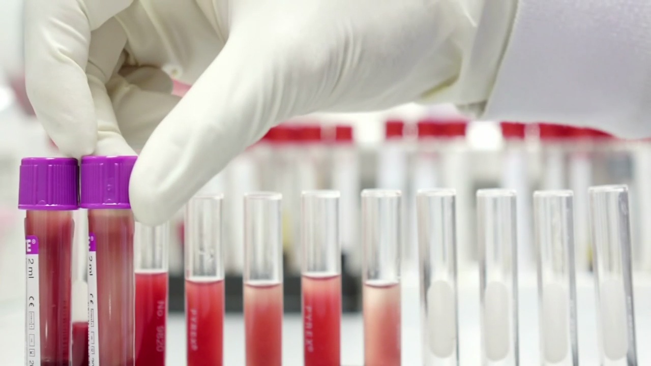 UPMC entering new phase of coronavirus testing