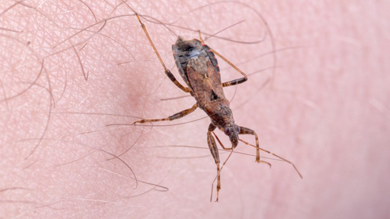 Insects Incheeks What is Chagas disease, the deadly condition caused by the kissing bug?