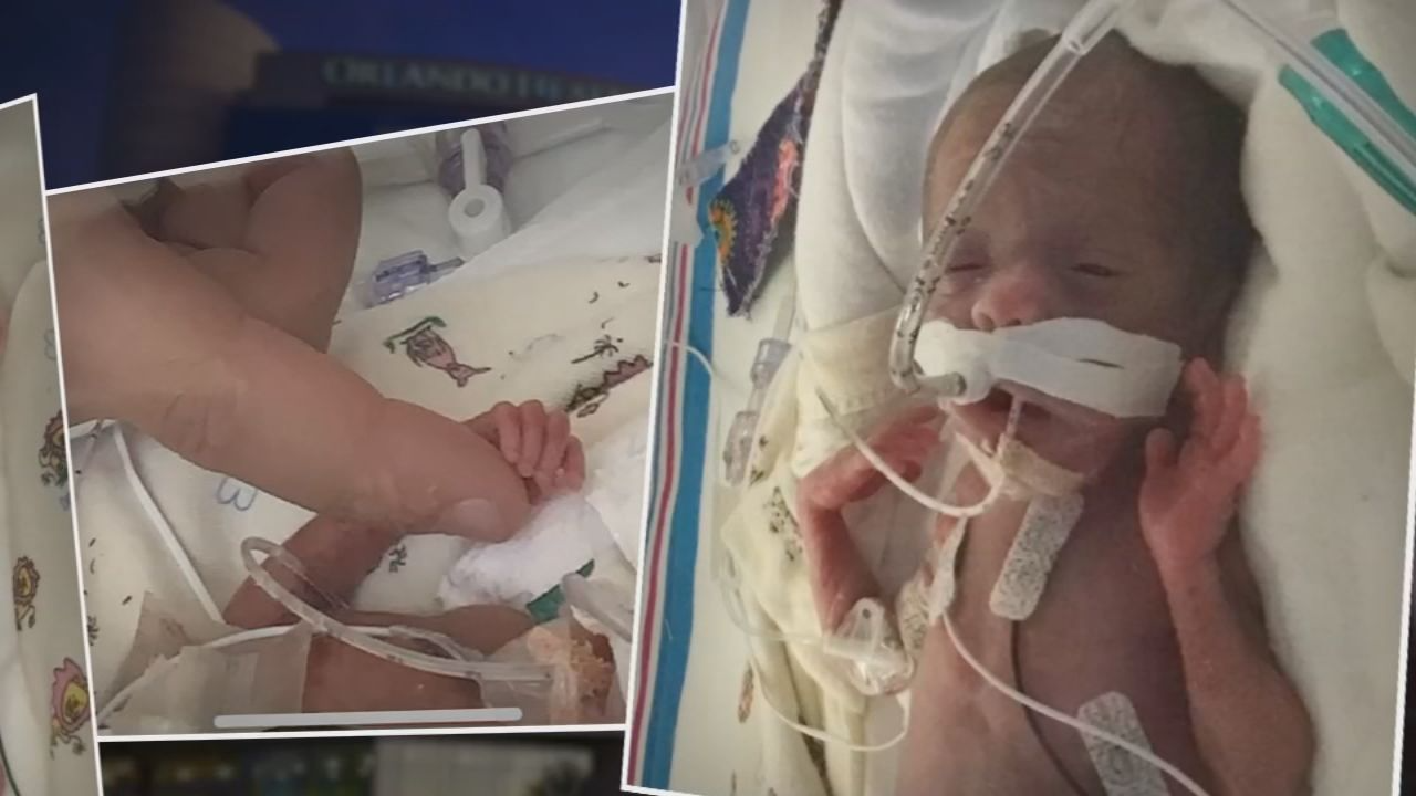 Micro Preemie Born In Orlando Weighing Only 12 Ounces Added To World S Tiniest Baby Registry Wftv