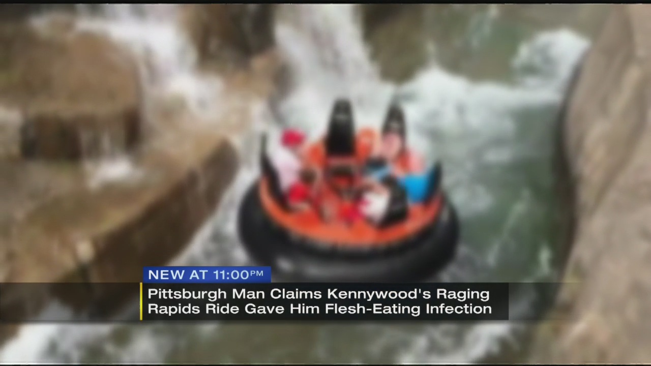Couple sues Kennywood after attack by parasite allegedly found in water