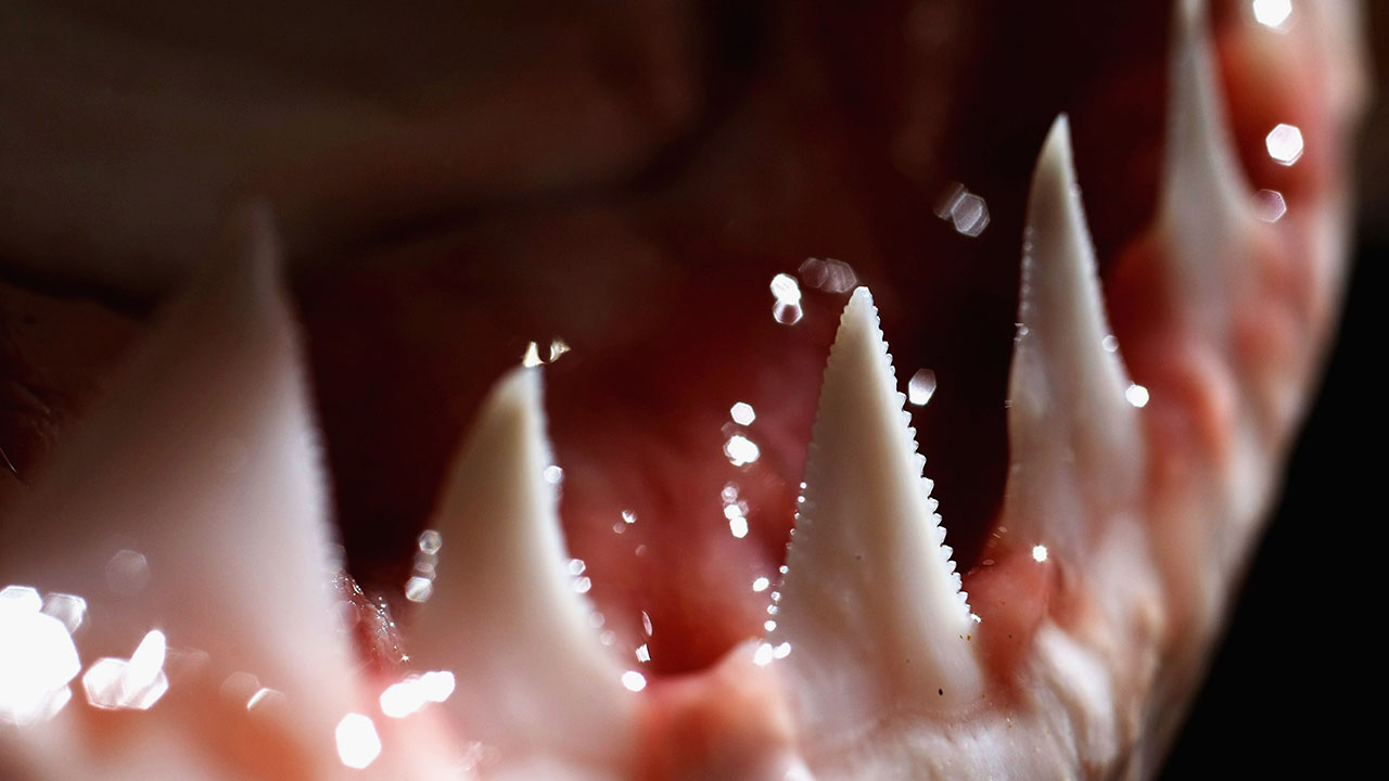 Shark bite leaves North Carolina teen with 40 puncture wounds WSOC TV